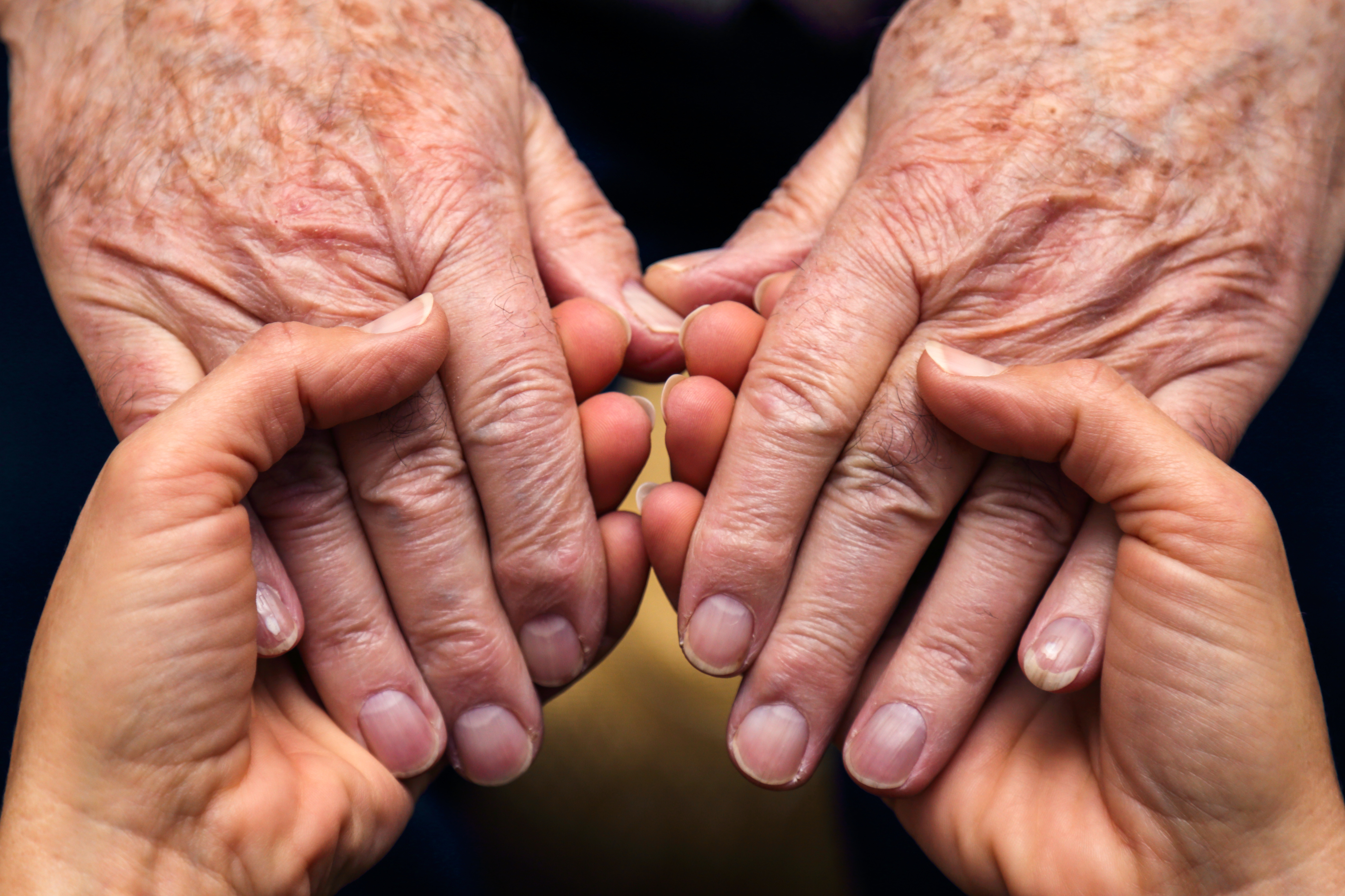 Artritis Reumatoide: Causas, consecuencias y la importancia del tratamiento