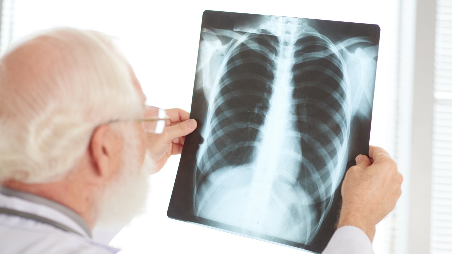 Sarcoma Doctor revisando radiografías